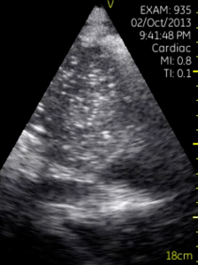 Screen Shot 2013-10-28 at 11.32.45 PM