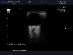 778_20160121_OEIL_0008