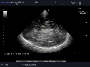 778_20160121_TCD_0007