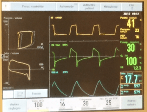 screen-shot-2017-01-05-at-10-45-21-pm